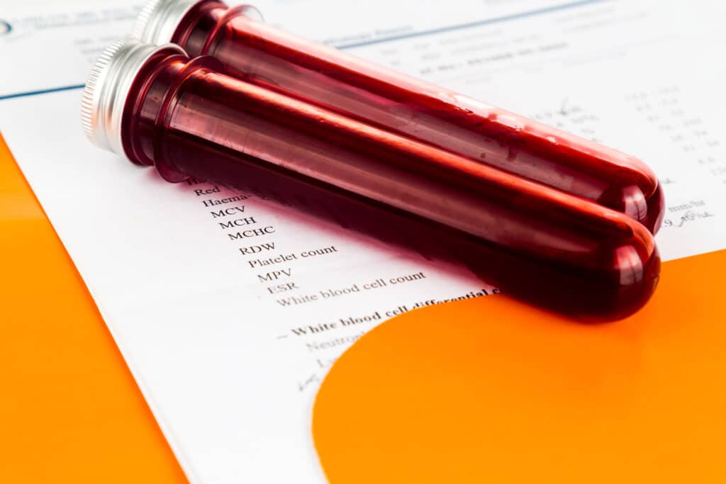 blood-sample-in-test-tubes-with-health-analysis