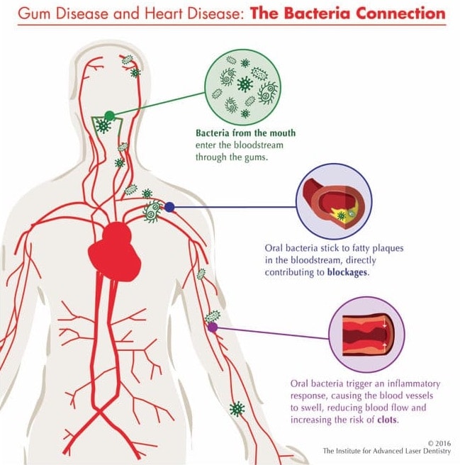 oral health and heart disease connection